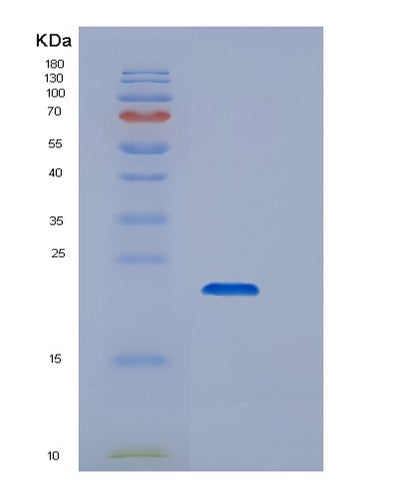 SDS-PAGE analysis of Human CD44 (Cd44 Antigen) - Recombinant Protein, CAT# BLT-06424P, showing >85% purity under 15% SDS-PAGE (Reduced)Human CD44 (Cd44 Antigen) - Recombinant Protein