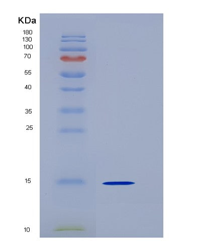 SDS-PAGE analysis of Human CST6 (Cystatin-M) - Recombinant Protein, CATHuman CST6 (Cystatin-M) - Recombinant Protein