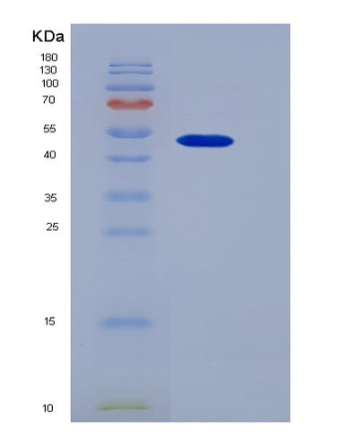 SDS-PAGE analysis of Human CD44 (Cd44 Antigen) - Recombinant Protein, CAT# BLT-06427P, showing >85% purity under 15% SDS-PAGE (Reduced)Human CD44 (Cd44 Antigen) - Recombinant Protein