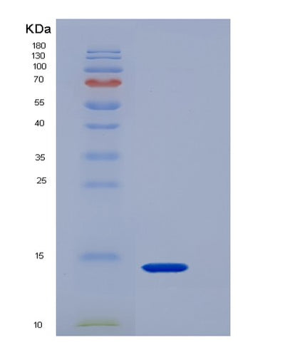 SDS-PAGE analysis of Mouse Agrp (Agouti-Related Protein) - Recombinant Protein, CAT# BLT-06433P, showing >85% purity under 15% SDS-PAGE (Reduced)Mouse Agrp (Agouti-Related Protein) - Recombinant Protein