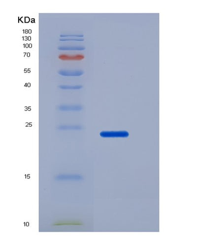 SDS-PAGE analysis of Mouse Slamf6 (Slam Family Member 6) - Recombinant Protein, CAT# BLT-06435P, showing >90% purity under 15% SDS-PAGE (Reduced)Mouse Slamf6 (Slam Family Member 6) - Recombinant Protein
