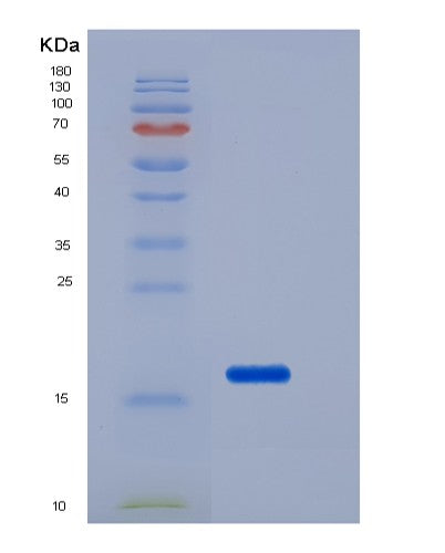 SDS-PAGE analysis of Human FZD10 (Frizzled-10) - Recombinant Protein, CATHuman FZD10 (Frizzled-10) - Recombinant Protein