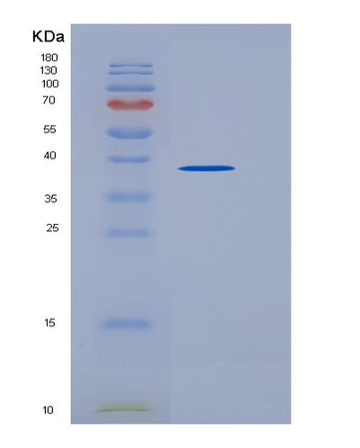 SDS-PAGE analysis of Mouse Agrp (Agouti-Related Protein) - Recombinant Protein, CAT# BLT-06440P, showing >95% purity under 15% SDS-PAGE (Reduced)Mouse Agrp (Agouti-Related Protein) - Recombinant Protein