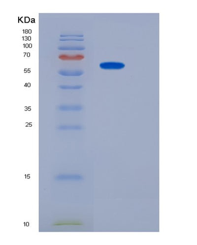 SDS-PAGE analysis of Human CADM4 (Cell Adhesion Molecule 4) - Recombinant Protein, CAT# BLT-06442P, showing >85% purity under 15% SDS-PAGE (Reduced)Human CADM4 (Cell Adhesion Molecule 4) - Recombinant Protein