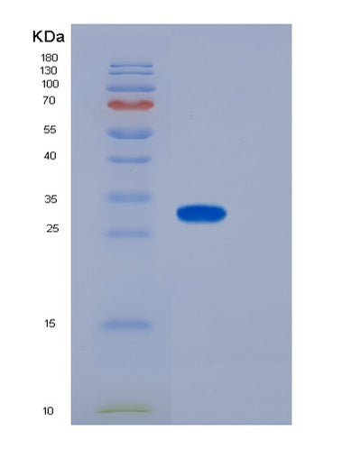 SDS-PAGE analysis of Mouse CD155 / PVR - Recombinant Protein, CAT# BLT-06444P, showing >90% purity under 15% SDS-PAGE (Reduced)Mouse CD155 / PVR - Recombinant Protein