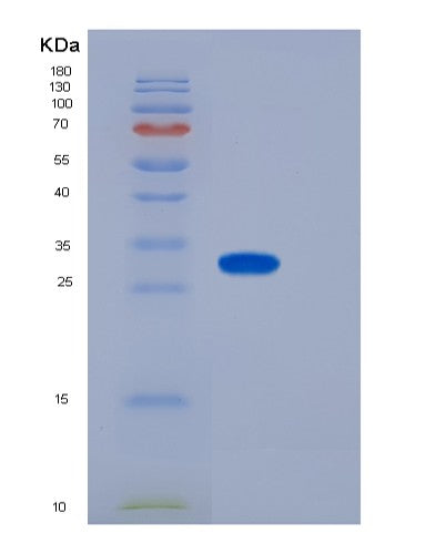 SDS-PAGE analysis of Mouse CD155 / PVR - Recombinant Protein, CATMouse CD155 / PVR - Recombinant Protein