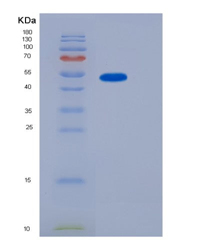 SDS-PAGE analysis of Human A1BG (Alpha-1B-Glycoprotein) - Recombinant Protein, CATHuman A1BG (Alpha-1B-Glycoprotein) - Recombinant Protein