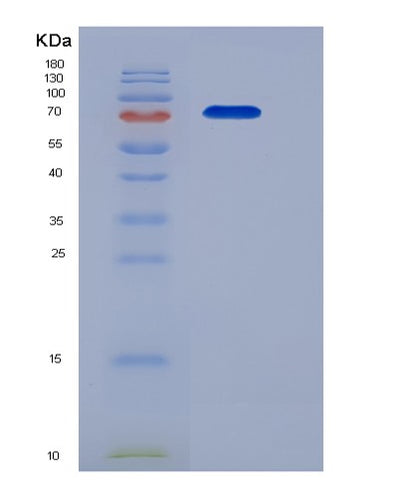 SDS-PAGE analysis of Mouse Kdr (Vascular Endothelial Growth Factor Receptor 2) - Recombinant Protein, CAT# BLT-06451P, showing >85% purity under 15% SDS-PAGE (Reduced)Mouse Kdr (Vascular Endothelial Growth Factor Receptor 2) - Recombinant Protein