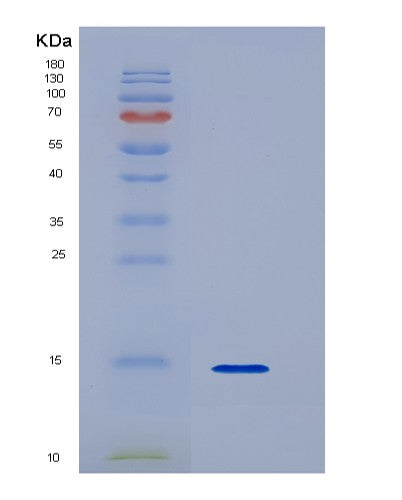 SDS-PAGE analysis of Human S100A9 (Protein S100-A9) - Recombinant Protein, CATHuman S100A9 (Protein S100-A9) - Recombinant Protein