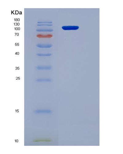 SDS-PAGE analysis of Mouse Kdr (Vascular Endothelial Growth Factor Receptor 2) - Recombinant Protein, CAT# BLT-06457P, showing >85% purity under 15% SDS-PAGE (Reduced)Mouse Kdr (Vascular Endothelial Growth Factor Receptor 2) - Recombinant Protein