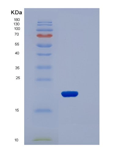 SDS-PAGE analysis of Mouse Clec6a (C-Type Lectin Domain Family 6 Member A) - Recombinant Protein, CATMouse Clec6a (C-Type Lectin Domain Family 6 Member A) - Recombinant Protein