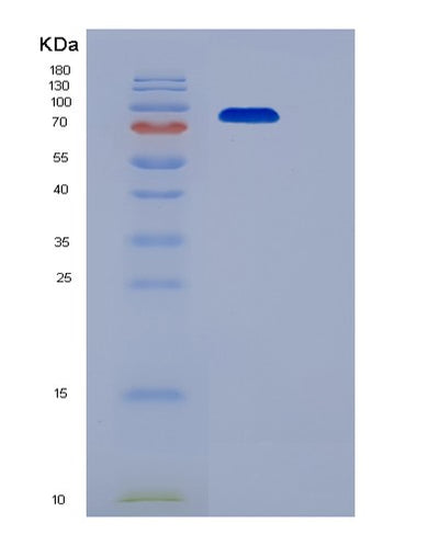 SDS-PAGE analysis of Human TEK (Angiopoietin-1 Receptor) - Recombinant Protein, CAT# BLT-06459P, showing >90% purity under 15% SDS-PAGE (Reduced)Human TEK (Angiopoietin-1 Receptor) - Recombinant Protein