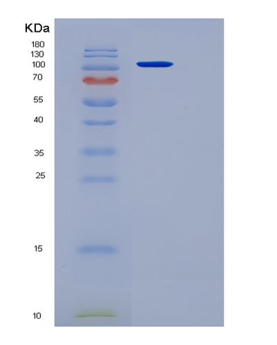 SDS-PAGE analysis of Mouse Ace2 (Angiotensin-Converting Enzyme 2) - Recombinant Protein, CAT# BLT-06460P, showing >85% purity under 15% SDS-PAGE (Reduced)Mouse Ace2 (Angiotensin-Converting Enzyme 2) - Recombinant Protein