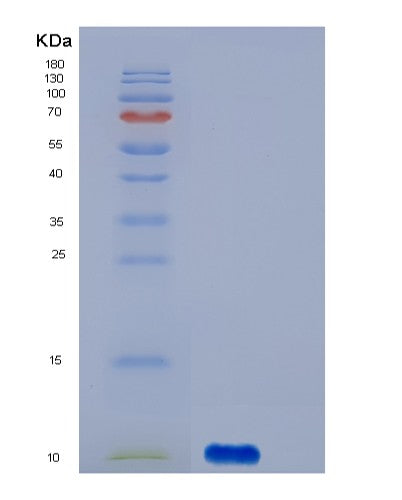 SDS-PAGE analysis of Human S100A12 (Protein S100-A12) - Recombinant Protein, CATHuman S100A12 (Protein S100-A12) - Recombinant Protein
