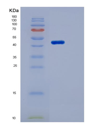 SDS-PAGE analysis of Human MSR1 (Macrophage Scavenger Receptor Types I And Ii) - Recombinant Protein, CAT# BLT-06464P, showing >95% purity under 15% SDS-PAGE (Reduced)Human MSR1 (Macrophage Scavenger Receptor Types I And Ii) - Recombinant Protein