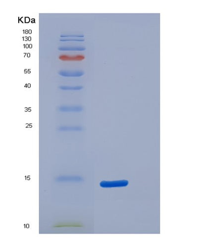 SDS-PAGE analysis of Human S100A5 (Protein S100-A5) - Recombinant Protein, CAT# BLT-06468P, showing >90% purity under 15% SDS-PAGE (Reduced)Human S100A5 (Protein S100-A5) - Recombinant Protein