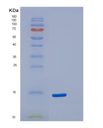 SDS-PAGE analysis of Human S100A5 (Protein S100-A5) - Recombinant Protein, CATHuman S100A5 (Protein S100-A5) - Recombinant Protein