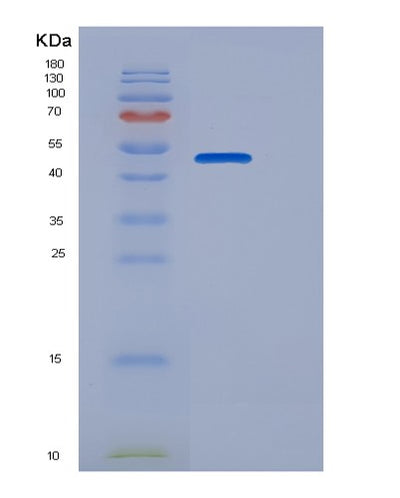 SDS-PAGE analysis of Human CANT1 (Soluble Calcium-Activated Nucleotidase 1) - Recombinant Protein, CAT# BLT-06469P, showing >85% purity under 15% SDS-PAGE (Reduced)Human CANT1 (Soluble Calcium-Activated Nucleotidase 1) - Recombinant Protein
