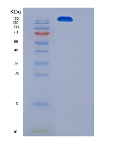 SDS-PAGE analysis of Human ITGAX (Integrin Alpha-X) - Recombinant Protein, CAT# BLT-08433P showing >90% purity under 15% SDS-PAGE (Reduced)Human ITGAX (Integrin Alpha-X) - Recombinant Protein