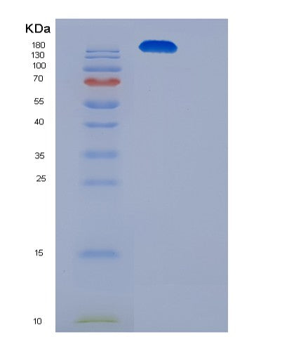 SDS-PAGE analysis of Human ITGAX (Integrin Alpha-X) - Recombinant Protein, CATHuman ITGAX (Integrin Alpha-X) - Recombinant Protein