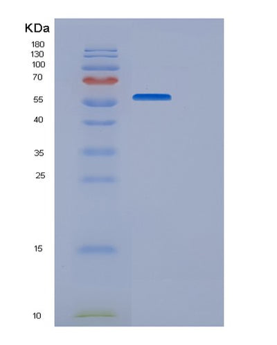 SDS-PAGE analysis of Human VSIG4 (V-Set And Immunoglobulin Domain-Containing Protein 4) - Recombinant Protein, CAT# BLT-06471P, showing >95% purity under 15% SDS-PAGE (Reduced)Human VSIG4 (V-Set And Immunoglobulin Domain-Containing Protein 4) - Recombinant Protein