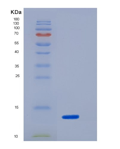 SDS-PAGE analysis of Mouse Pdpn (Podoplanin) - Recombinant Protein, CATMouse Pdpn (Podoplanin) - Recombinant Protein