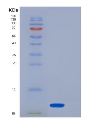 SDS-PAGE analysis of Human S100A8 (Protein S100-A8) - Recombinant Protein, CAT# BLT-06481P, showing >90% purity under 15% SDS-PAGE (Reduced)Human S100A8 (Protein S100-A8) - Recombinant Protein