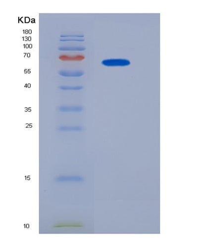 SDS-PAGE analysis of Mouse Cdh5 (Cadherin-5) - Recombinant Protein, CAT# BLT-06484P, showing >90% purity under 15% SDS-PAGE (Reduced)Mouse Cdh5 (Cadherin-5) - Recombinant Protein
