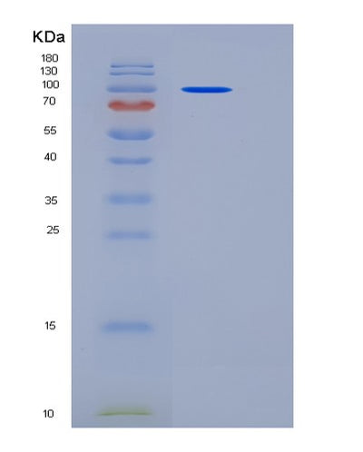 SDS-PAGE analysis of Human NFASC (Neurofascin) - Recombinant Protein, CAT# BLT-06489P, showing >95% purity under 15% SDS-PAGE (Reduced)Human NFASC (Neurofascin) - Recombinant Protein