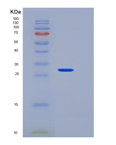 SDS-PAGE analysis of Human HAGH (Hydroxyacylglutathione Hydrolase, Mitochondrial) - Recombinant Protein, CAT# BLT-06490P, showing >90% purity under 15% SDS-PAGE (Reduced)Human HAGH (Hydroxyacylglutathione Hydrolase, Mitochondrial) - Recombinant Protein