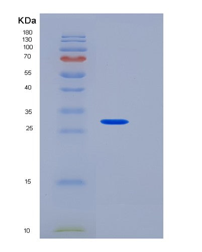 SDS-PAGE analysis of Human HAGH (Hydroxyacylglutathione Hydrolase, Mitochondrial) - Recombinant Protein, CATHuman HAGH (Hydroxyacylglutathione Hydrolase, Mitochondrial) - Recombinant Protein