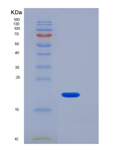 SDS-PAGE analysis of Mouse VSIG4 - Recombinant Protein, CAT# BLT-06493P, showing >85% purity under 15% SDS-PAGE (Reduced)Mouse VSIG4 - Recombinant Protein