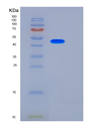 SDS-PAGE analysis of Mouse Cpb2 (Carboxypeptidase B2) - Recombinant Protein, CAT# BLT-06495P, showing >85% purity under 15% SDS-PAGE (Reduced)Mouse Cpb2 (Carboxypeptidase B2) - Recombinant Protein