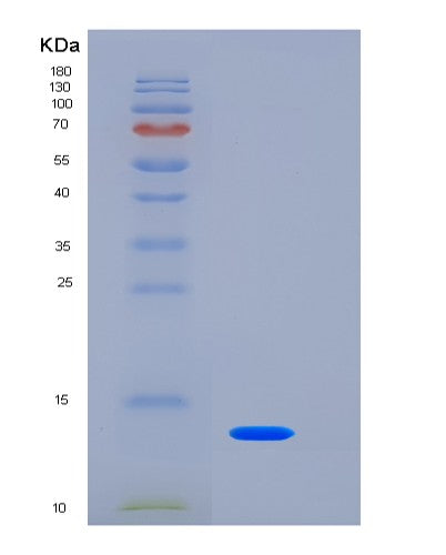 SDS-PAGE analysis of Human TSPAN8 (Tetraspanin-8) - Recombinant Protein, CATHuman TSPAN8 (Tetraspanin-8) - Recombinant Protein
