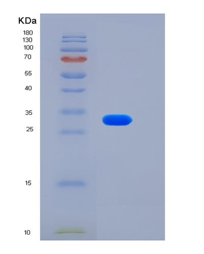 SDS-PAGE analysis of Human LSAMP (Limbic System-Associated Membrane Protein) - Recombinant Protein, CAT# BLT-06497P, showing >90% purity under 15% SDS-PAGE (Reduced)Human LSAMP (Limbic System-Associated Membrane Protein) - Recombinant Protein