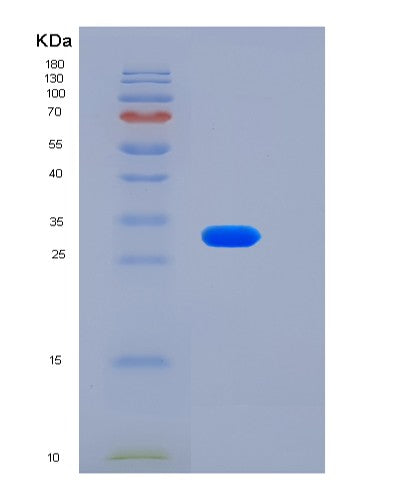 SDS-PAGE analysis of Human LSAMP (Limbic System-Associated Membrane Protein) - Recombinant Protein, CATHuman LSAMP (Limbic System-Associated Membrane Protein) - Recombinant Protein
