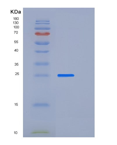 SDS-PAGE analysis of Human AZU1 (Azurocidin) - Recombinant Protein, CATHuman AZU1 (Azurocidin) - Recombinant Protein