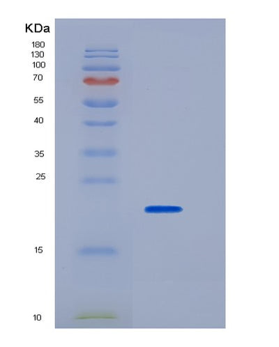 SDS-PAGE analysis of Mouse Fcgr2 (Low Affinity Immunoglobulin Gamma Fc Region Receptor Ii) - Recombinant Protein, CAT# BLT-06509P, showing >90% purity under 15% SDS-PAGE (Reduced)Mouse Fcgr2 (Low Affinity Immunoglobulin Gamma Fc Region Receptor Ii) - Recombinant Protein