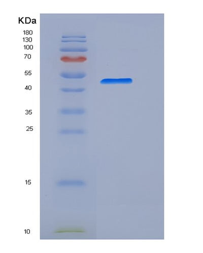SDS-PAGE analysis of Mouse Cd33 (Myeloid Cell Surface Antigen Cd33) - Recombinant Protein, CAT# BLT-06510P, showing >95% purity under 15% SDS-PAGE (Reduced)Mouse Cd33 (Myeloid Cell Surface Antigen Cd33) - Recombinant Protein