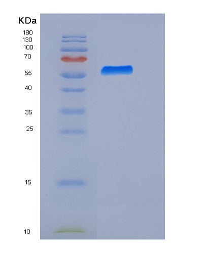 SDS-PAGE analysis of Human BTD (Biotinidase) - Recombinant Protein, CATHuman BTD (Biotinidase) - Recombinant Protein