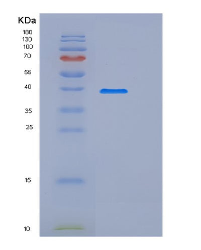 SDS-PAGE analysis of Mouse Sirpa (Tyrosine-Protein Phosphatase Non-Receptor Type Substrate 1) - Recombinant Protein, CAT# BLT-06514P, showing >95% purity under 15% SDS-PAGE (Reduced)Mouse Sirpa (Tyrosine-Protein Phosphatase Non-Receptor Type Substrate 1) - Recombinant Protein