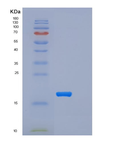 SDS-PAGE analysis of Mouse Trem2 (Triggering Receptor Expressed On Myeloid Cells 2) - Recombinant Protein, CAT# BLT-06517P, showing >95% purity under 15% SDS-PAGE (Reduced)Mouse Trem2 (Triggering Receptor Expressed On Myeloid Cells 2) - Recombinant Protein