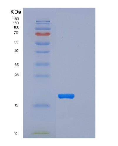 SDS-PAGE analysis of Mouse Trem2 (Triggering Receptor Expressed On Myeloid Cells 2) - Recombinant Protein, CATMouse Trem2 (Triggering Receptor Expressed On Myeloid Cells 2) - Recombinant Protein