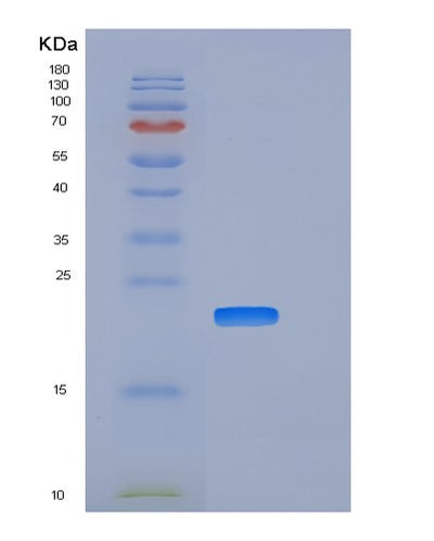 SDS-PAGE analysis of Mouse Clec7a (C-Type Lectin Domain Family 7 Member A) - Recombinant Protein, CAT# BLT-06519P, showing >95% purity under 15% SDS-PAGE (Reduced)Mouse Clec7a (C-Type Lectin Domain Family 7 Member A) - Recombinant Protein