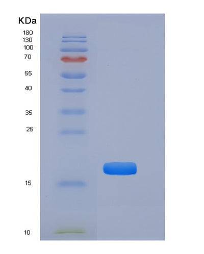 SDS-PAGE analysis of Mouse Tnfrsf19 (Tumor Necrosis Factor Receptor Superfamily Member 19) - Recombinant Protein, CAT# BLT-06521P, showing >85% purity under 15% SDS-PAGE (Reduced)Mouse Tnfrsf19 (Tumor Necrosis Factor Receptor Superfamily Member 19) - Recombinant Protein