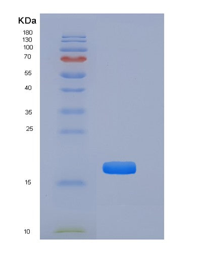 SDS-PAGE analysis of Mouse Tnfrsf19 (Tumor Necrosis Factor Receptor Superfamily Member 19) - Recombinant Protein, CATMouse Tnfrsf19 (Tumor Necrosis Factor Receptor Superfamily Member 19) - Recombinant Protein