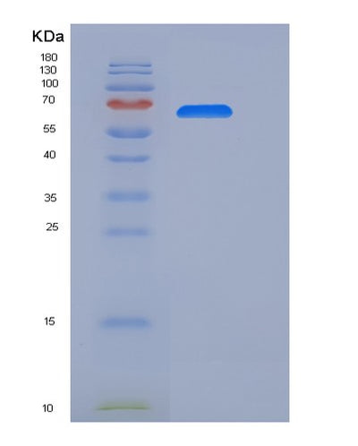 SDS-PAGE analysis of Mouse Il6st (Interleukin-6 Receptor Subunit Beta) - Recombinant Protein, CAT# BLT-06523P, showing >85% purity under 15% SDS-PAGE (Reduced)Mouse Il6st (Interleukin-6 Receptor Subunit Beta) - Recombinant Protein