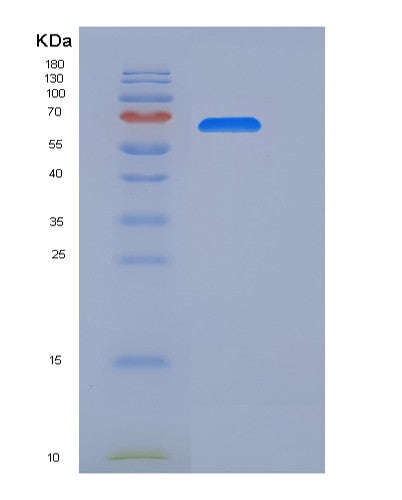 SDS-PAGE analysis of Mouse Il6st (Interleukin-6 Receptor Subunit Beta) - Recombinant Protein, CATMouse Il6st (Interleukin-6 Receptor Subunit Beta) - Recombinant Protein
