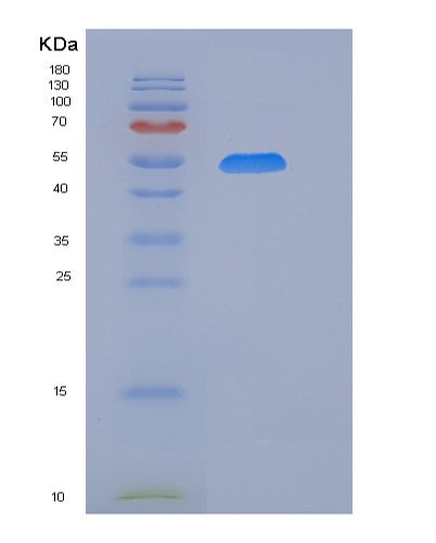 SDS-PAGE analysis of Mouse Cd226 (Cd226 Antigen) - Recombinant Protein, CATMouse Cd226 (Cd226 Antigen) - Recombinant Protein