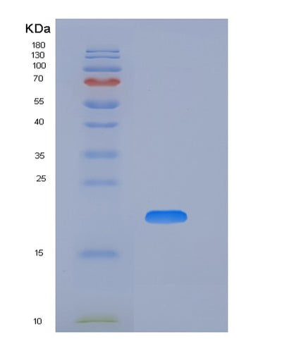 SDS-PAGE analysis of Human CD74 (Hla Class Ii Histocompatibility Antigen Gamma Chain) - Recombinant Protein, CAT# BLT-06530P, showing >90% purity under 15% SDS-PAGE (Reduced)Human CD74 (Hla Class Ii Histocompatibility Antigen Gamma Chain) - Recombinant Protein
